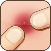 Pimple Popper Mod APK