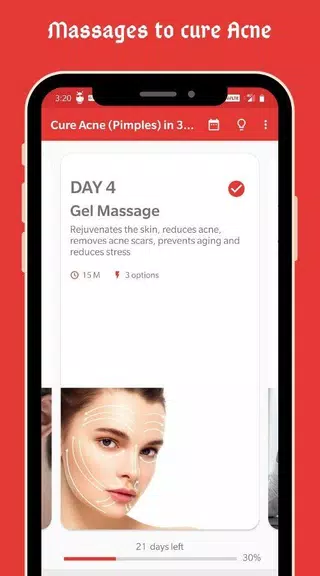 Cure Acne (Pimples) in 30 Days Screenshot4